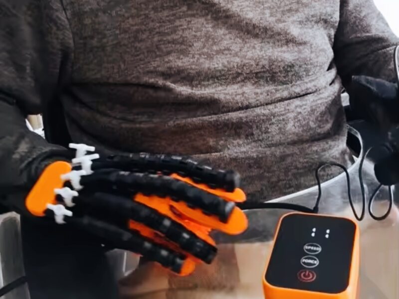 Robotska rukavica za razvoj motorike šake