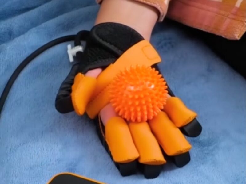 Robotska rukavica za razvoj motorike šake