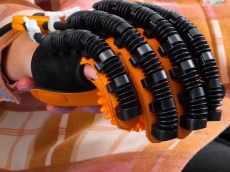 Robotska rukavica za razvoj motorike šake